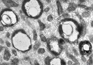 jejunum … unclassified vacuoles in enterocytes